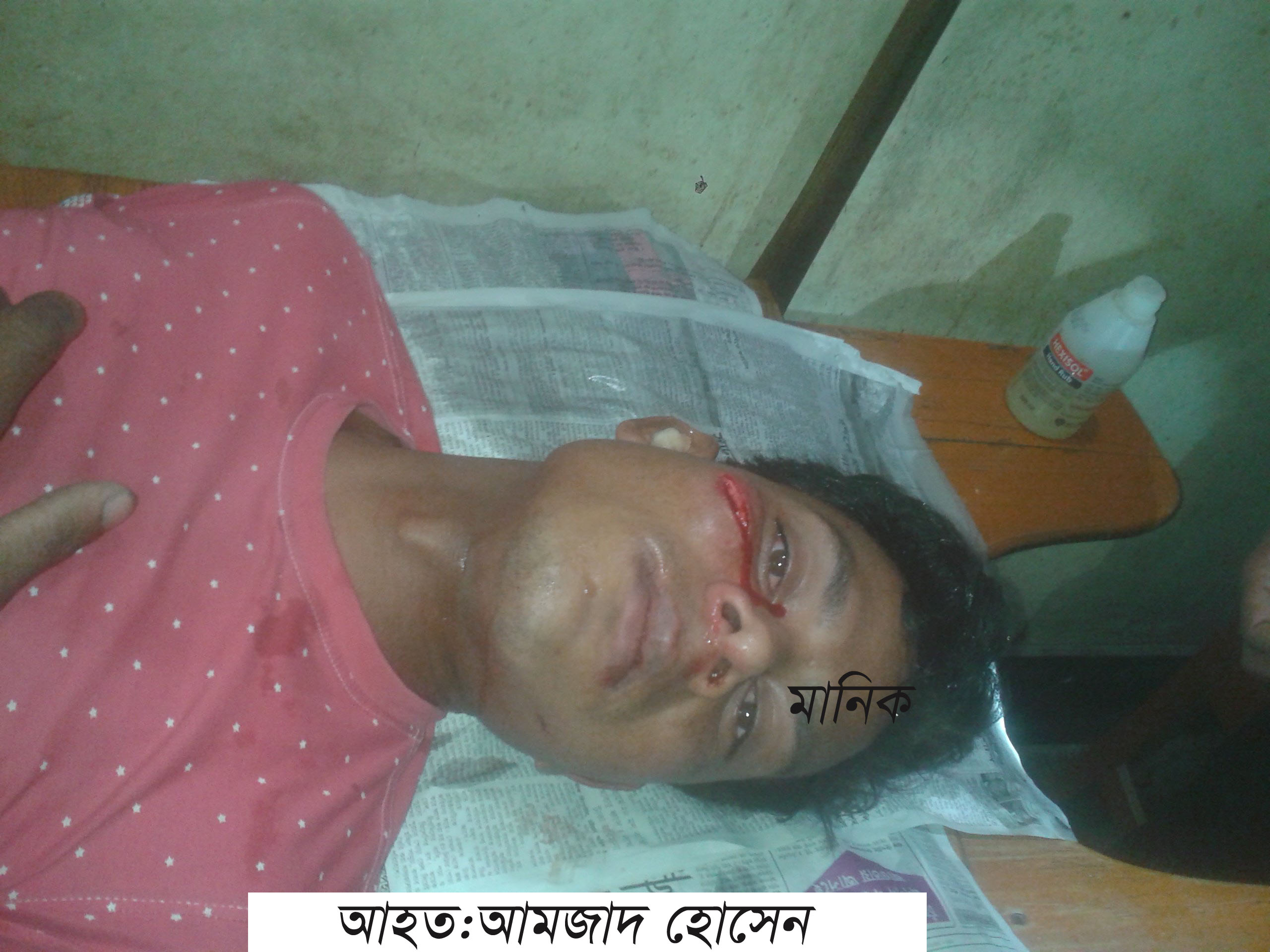 রানীরবন্দরে সড়ক দুর্ঘটনায় ৫ জন যাএী আহত