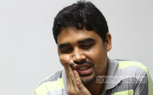 মাড়ি ফুলে ব্যথা দ্রুত আরামের ঘরোয়া পন্থা