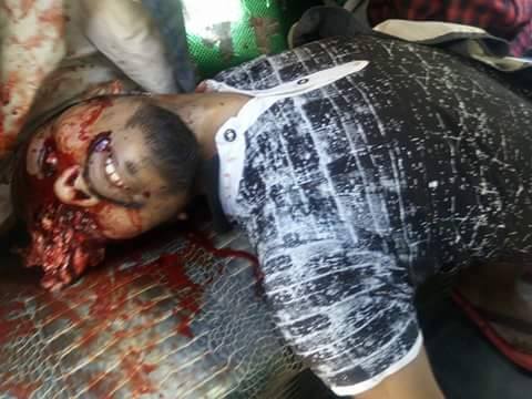 এইমাত্র পাওয়া : বিয়ানী বাজার সরকারী কলেজে ছাত্রলীগের দু গ্রুপে সংঘর্ষে ১ জন নিহত