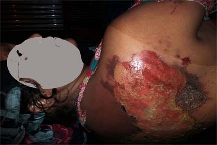 বিয়ানীবাজারে ভাসুরের নির্যাতনের শিকার গৃহবধু আছিয়া