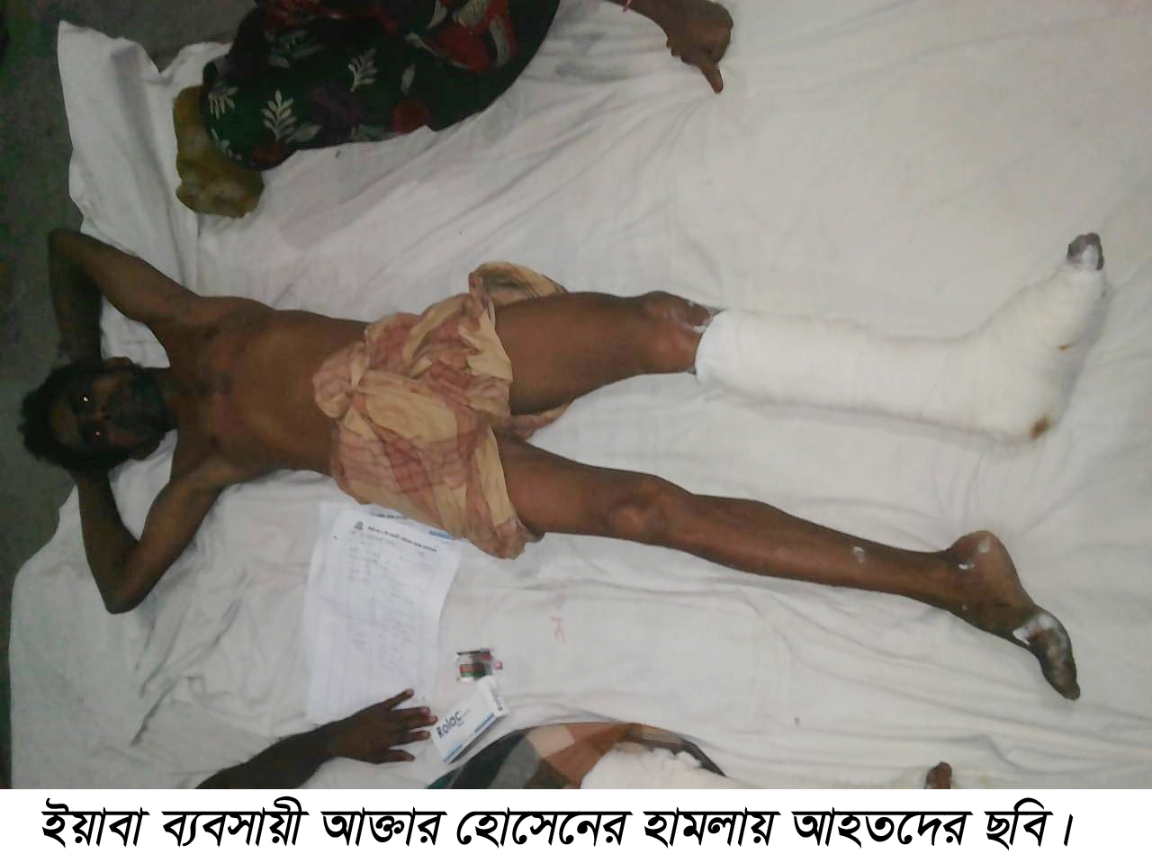 জগন্নাথপুরে ইয়াবা ব্যবসায়ীর হামলায় আহত ২