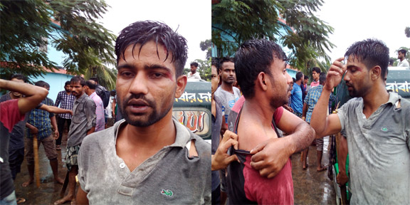 ব্রেকিং নিউজ: পরিবহন ধর্মঘটে কানলী ব্রীজ রণক্ষেত্র: আহত ১০