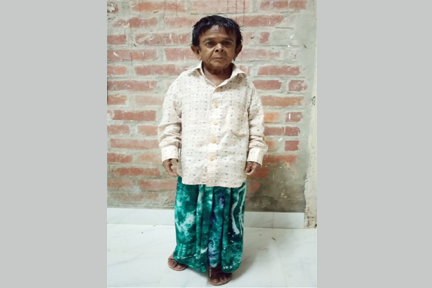 বিশ্বের সবচেয়ে কম ওজনের মানুষ বিশ্বনাথের চেরাগ আলী