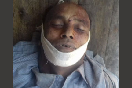 হাকালুকিতে জমি নিয়ে সংঘর্ষে নিহত ১আহত ১৫