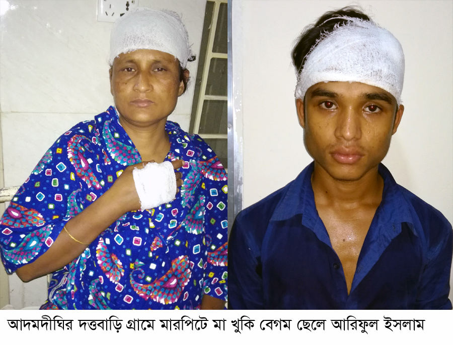তুচ্ছ ঘটনাকে কেন্দ্র করে মহিলা মেম্বারসহ ৭ জন আহত