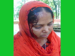 বড়লেখায় মুক্তিযোদ্ধা পরিবার নির্যাতিত, রক্তাক্ত জখম, থানায় অভিযোগ দায়ের