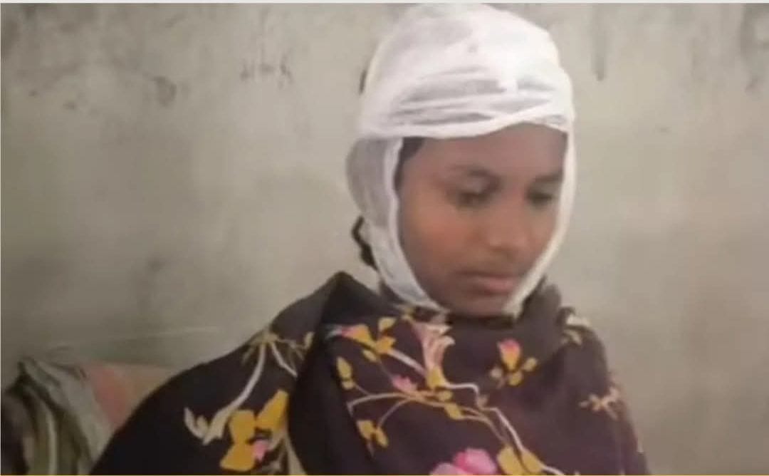 ডাস্টার দিয়ে পিটিয়ে ছাত্রীকে রক্তাক্ত করলেন প্রধান শিক্ষক!